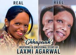 Chhapaak movie can be impactful to change the mindset of the people 